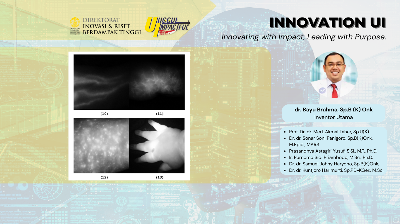 Inovasi Kamera Near Infrared Modifikasi untuk Pencitraan Fluoresen di Bidang Medis